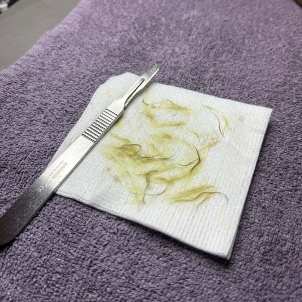 Dermaplaning Add-On at Darling Aesthetic in Austin, TX