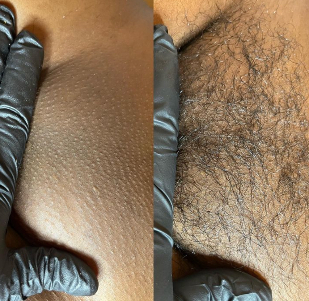 Brazilian Wax