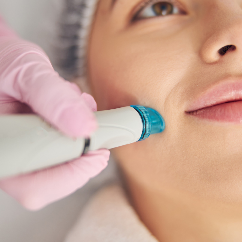 HydroDermabrasion Only