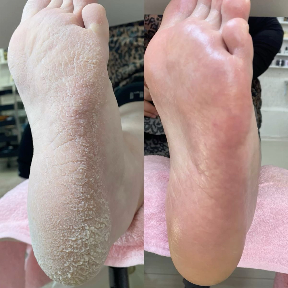 Deep Restorative Pedicure