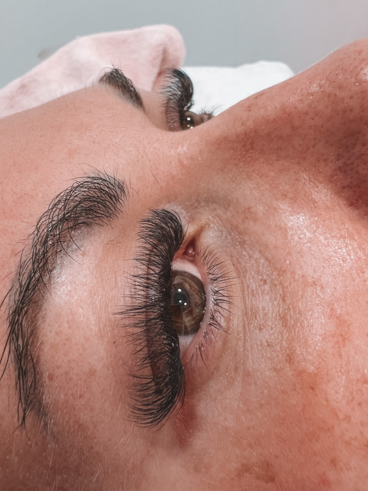 Hybrid Lash Set