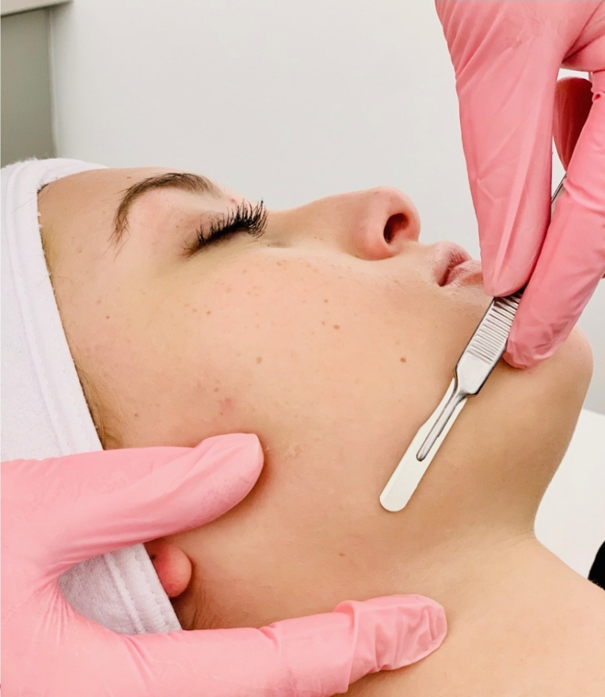 Express Dermaplane