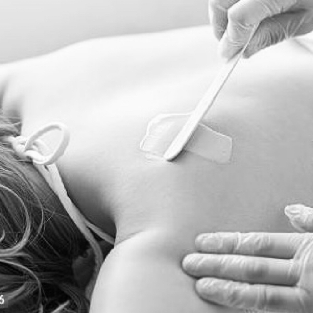 Back Reset - Full at KD Aesthetics in Concord, NC