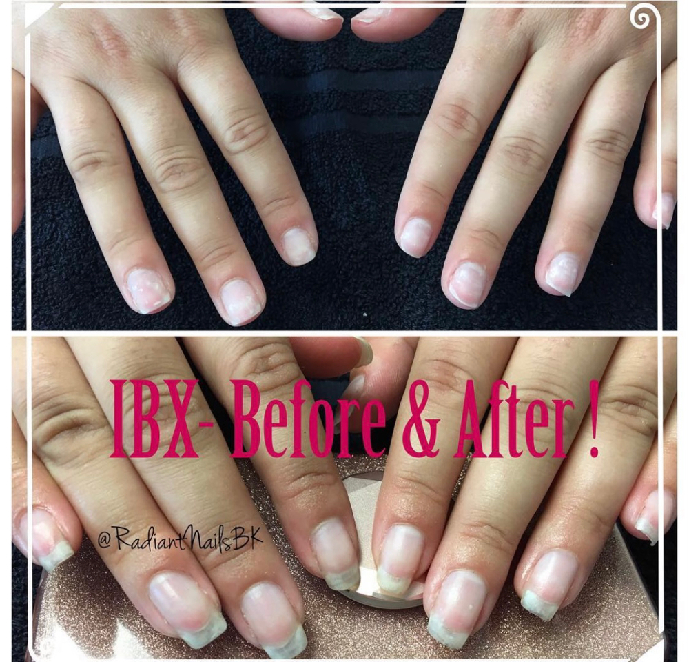 IBX Nail Repair Treatment