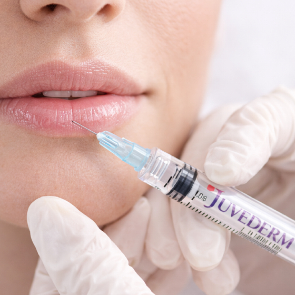 Lip Fillers at Norma Garcia *The Beauty Bar* in Midland, TX