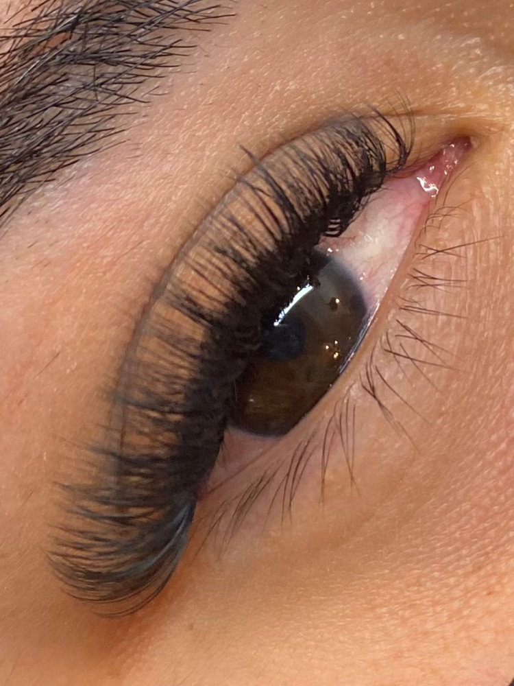 Mini Fills at LCX ESTHETICS in Santa Paula, CA