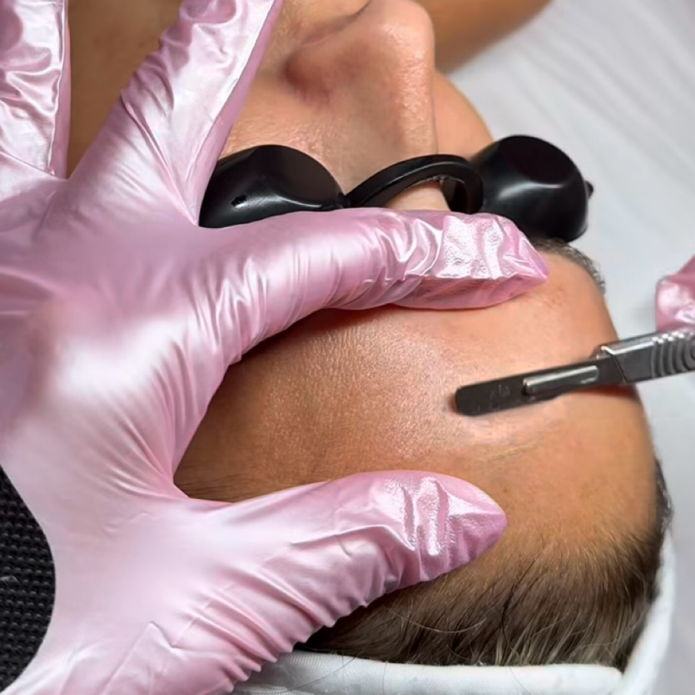 Dermaplane at LucentSkin Facial Studio in Roswell, GA