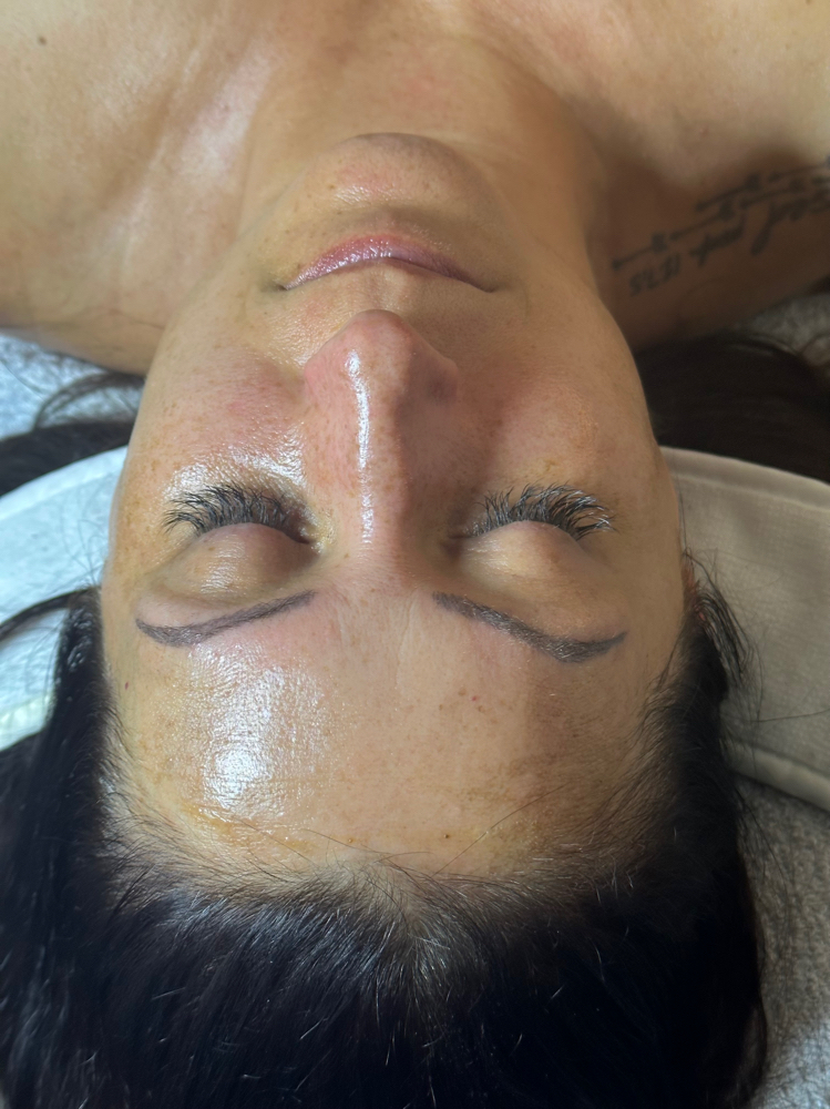 Dermaplaning With Facial