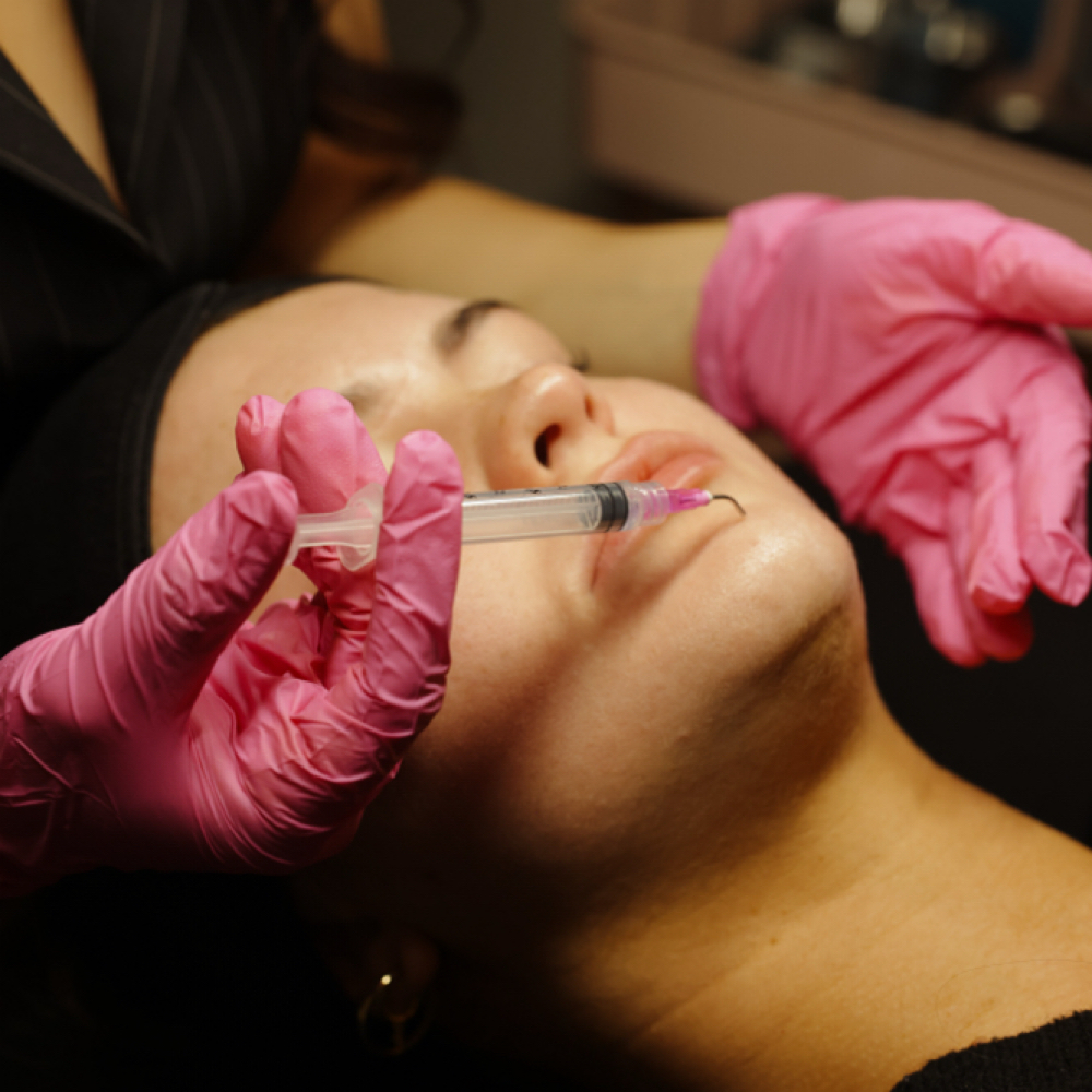 FactorFive RDS Peel at Lady Mae Esthetic’s in Redmond, OR