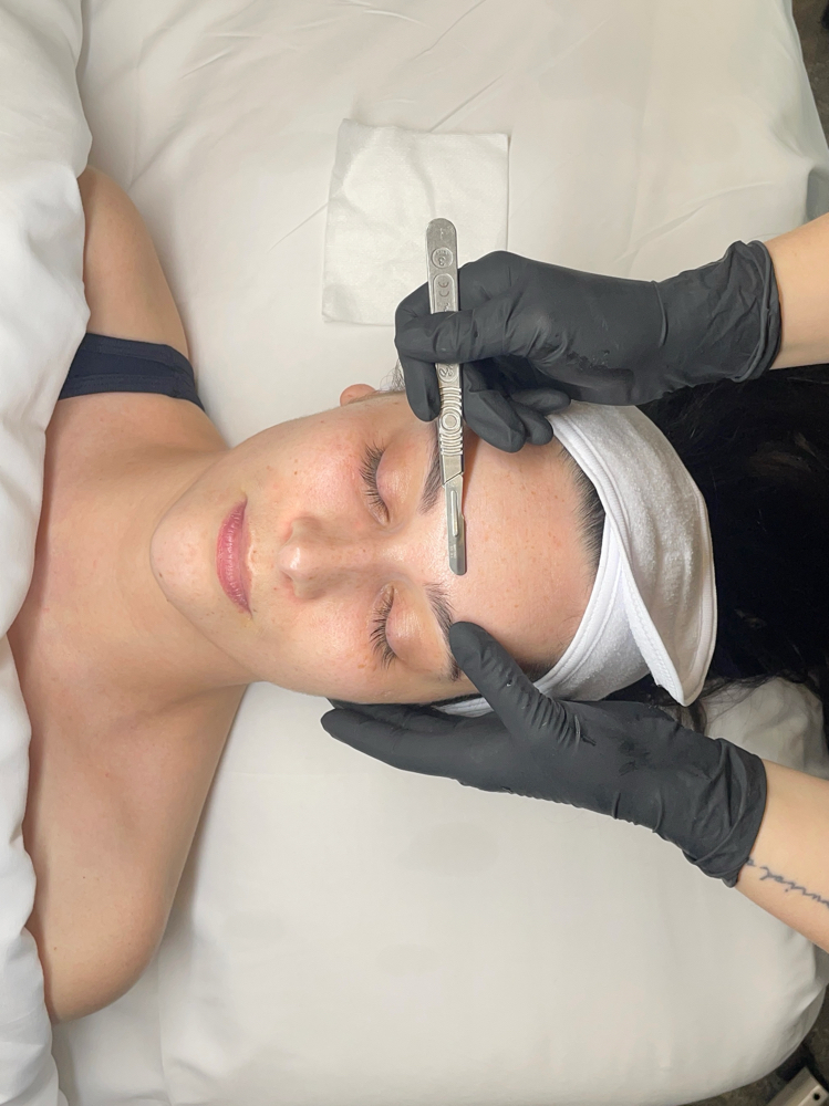 Dermaplane Facial