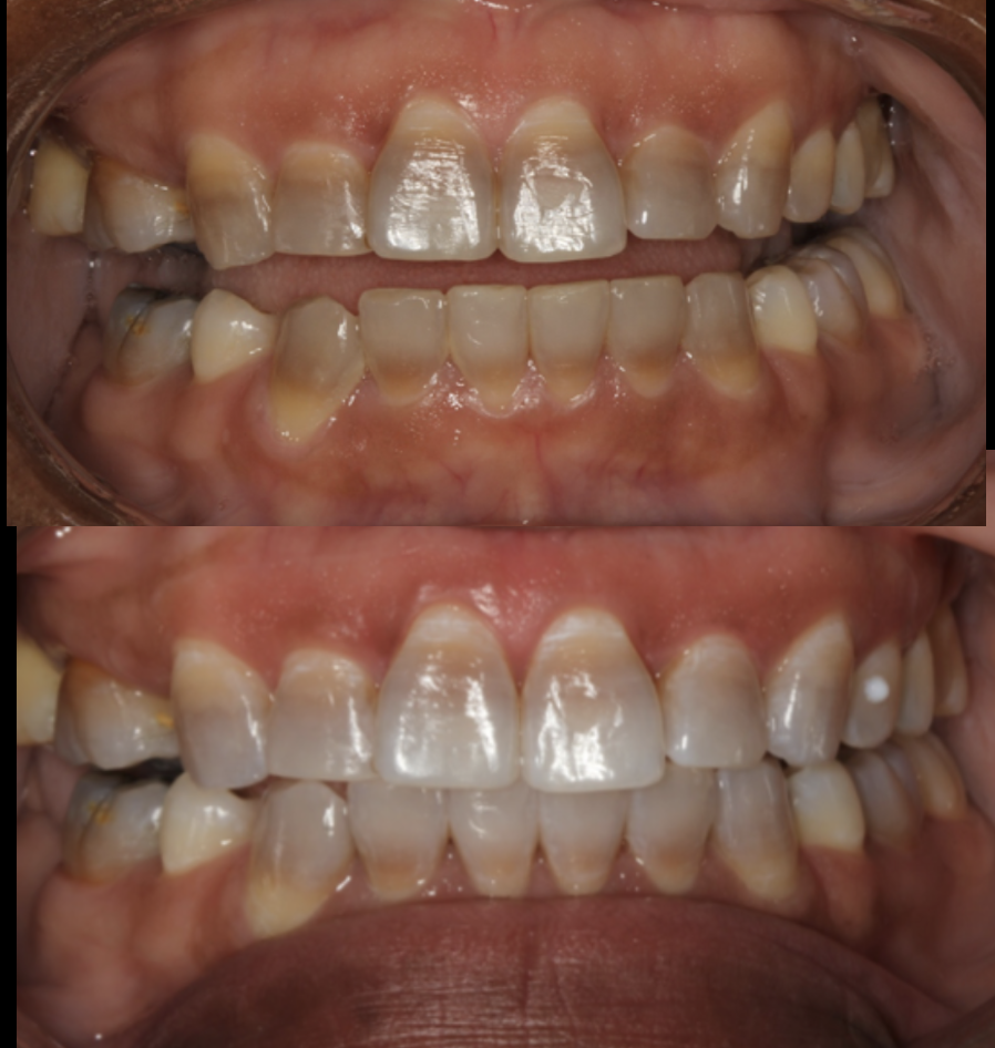 The Tetracycline Transformation
