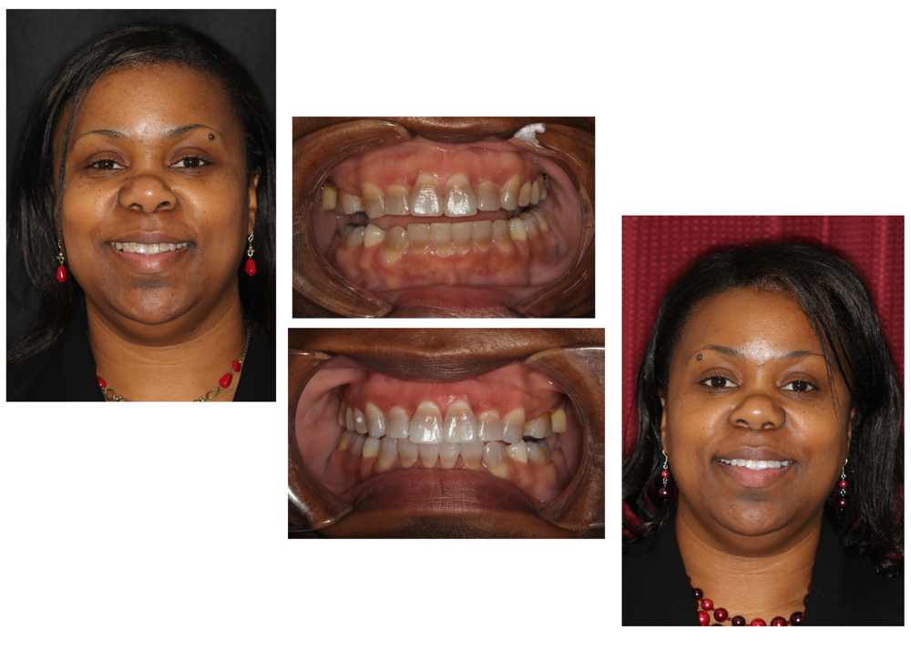 The Tetracycline Transformation