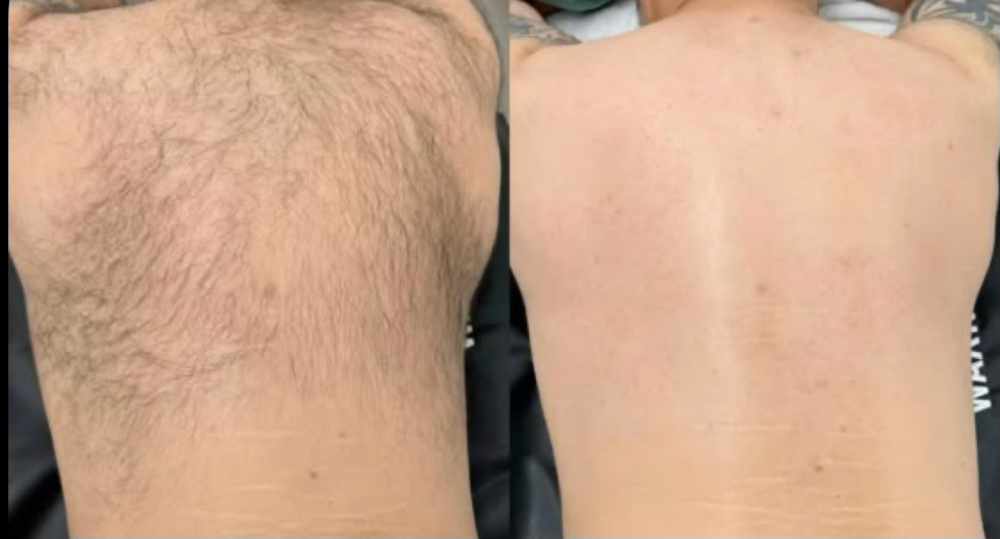 Full Back Wax at Sunshine Beauty Salon in Corning, CA