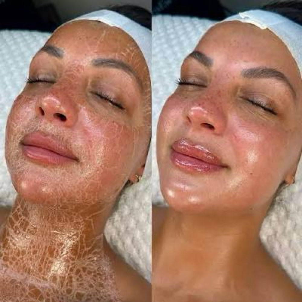 Firming peptide mask at Esthetics by Duly, LLC in crest hill, IL