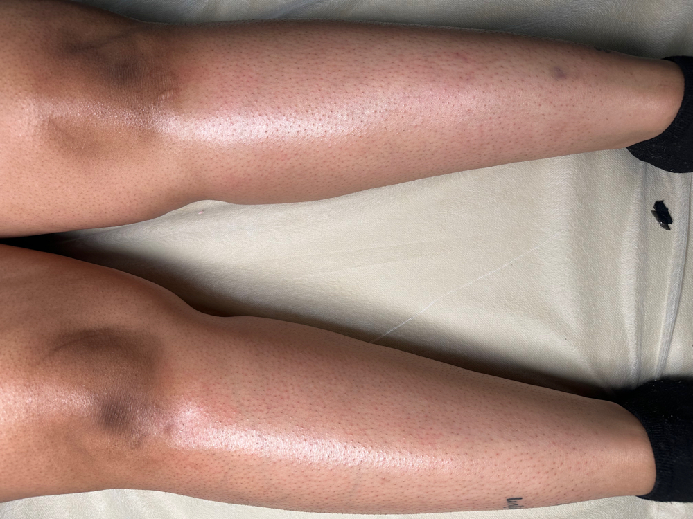 Half Leg Wax at J Esthetics in Homewood, IL