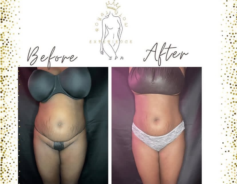 Waistline Snatched at Royal Glow Experience LLC in Houston, TX