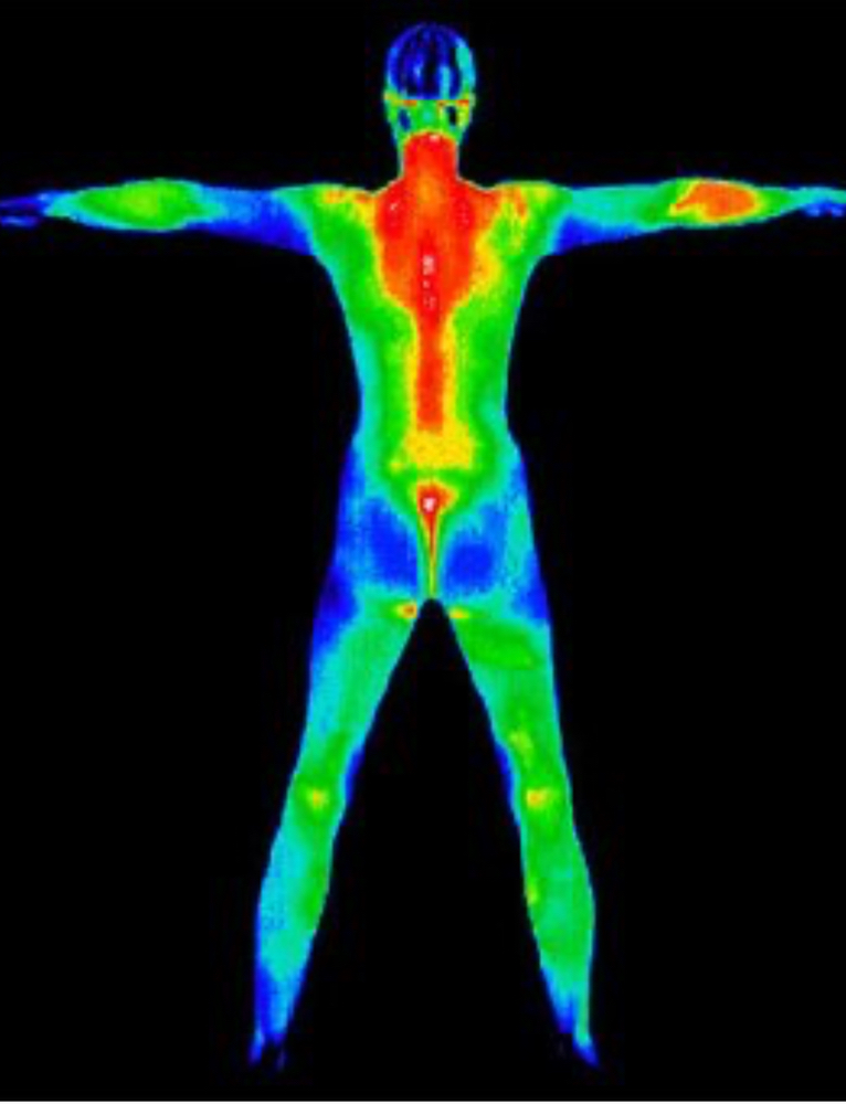 Thermography Face & Body Scan