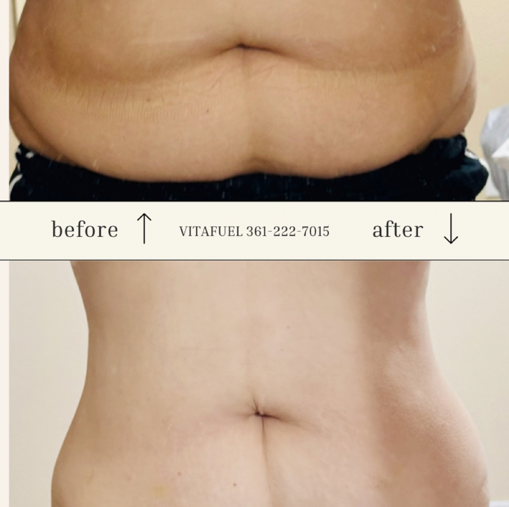 Slimming Detox Sauna Wrap at VitaFuel by Claudia in Corpus Christi, TX