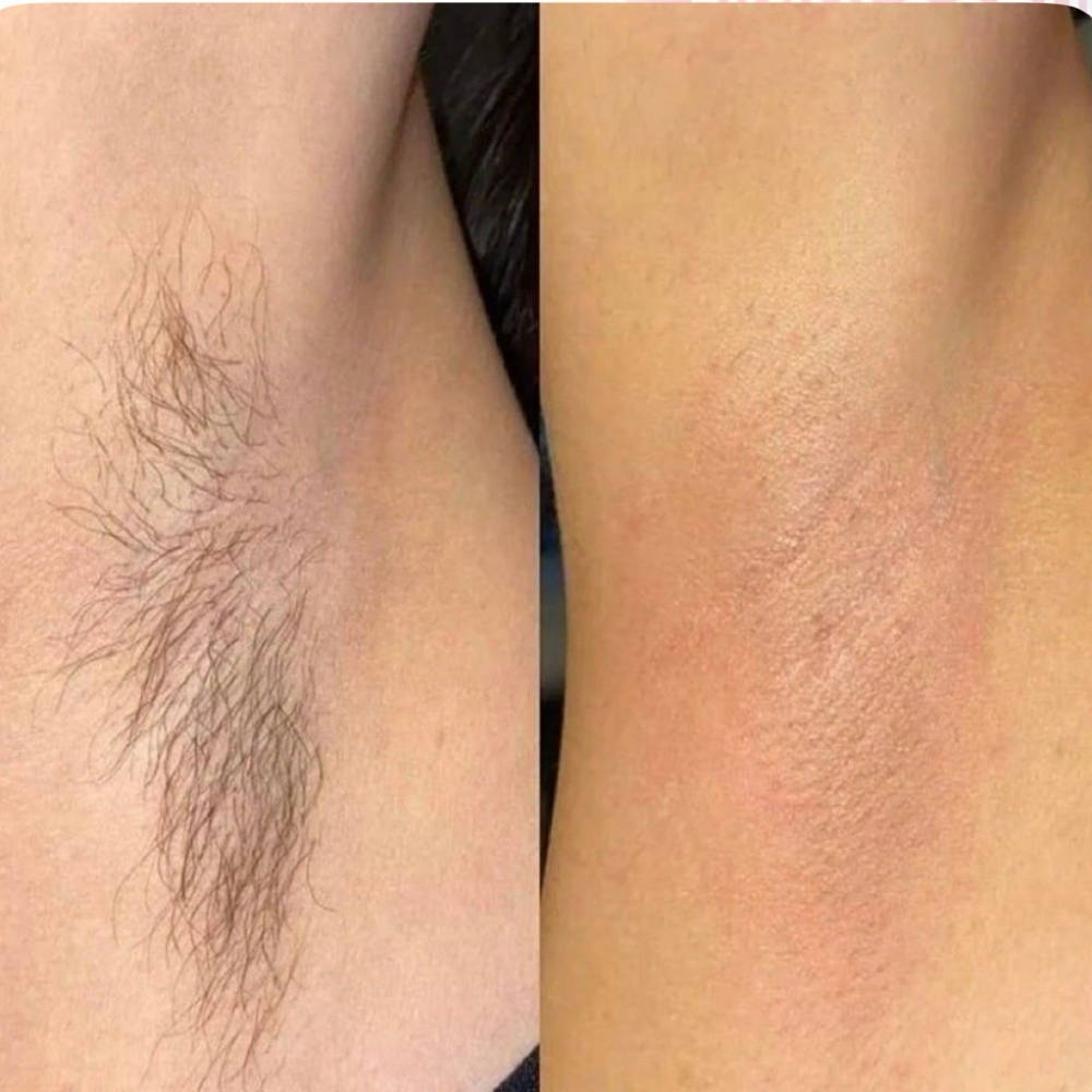 Underarm Waxing at The Shelton Studio in Shelbyville, TN