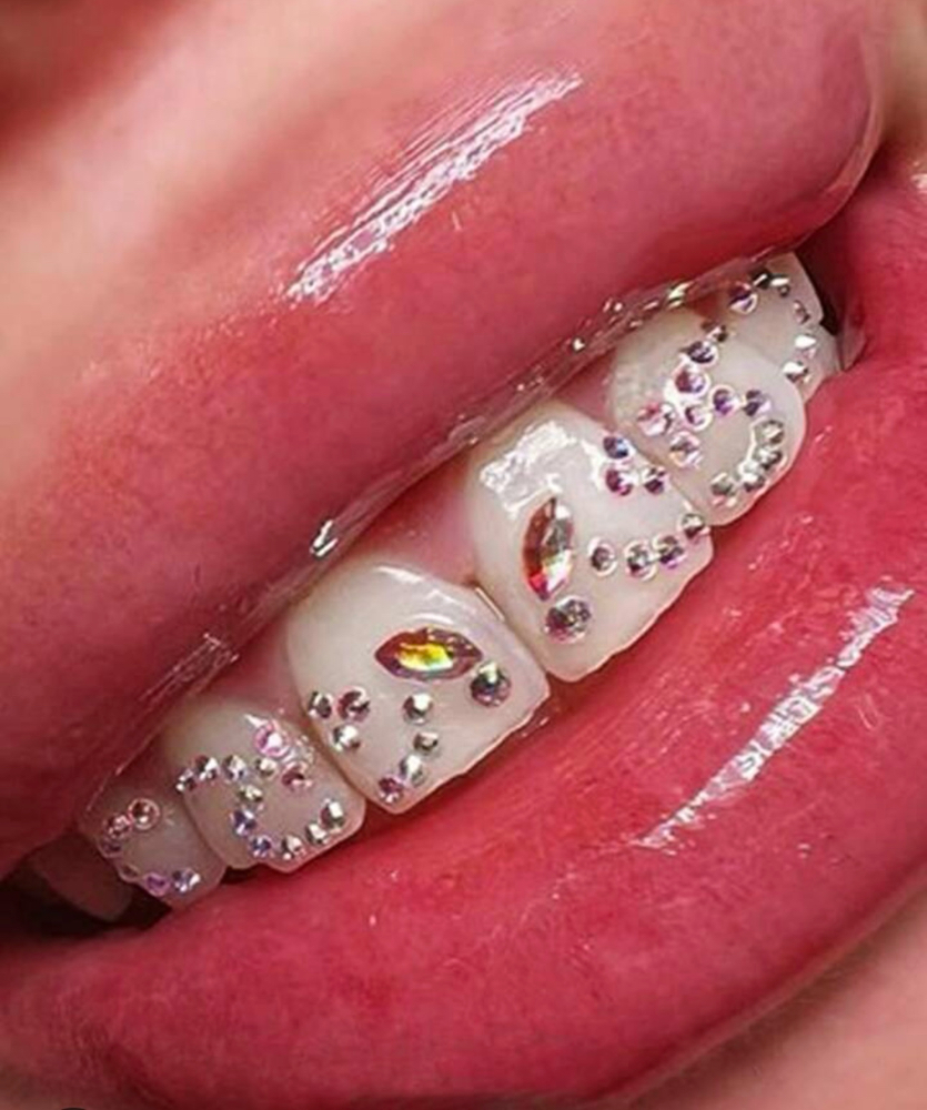 Tooth Gems