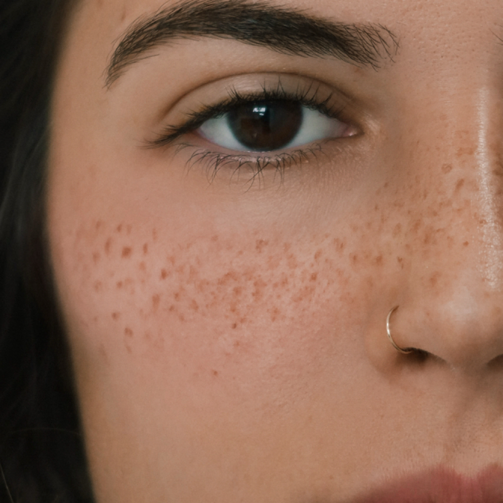 Permanent Freckles at MS Beauty Studio NY in Staten Island, NY