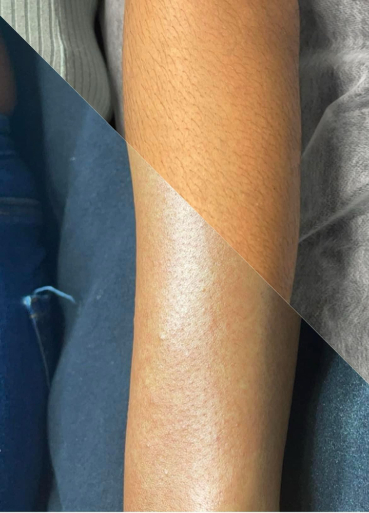 Half Arm Wax
