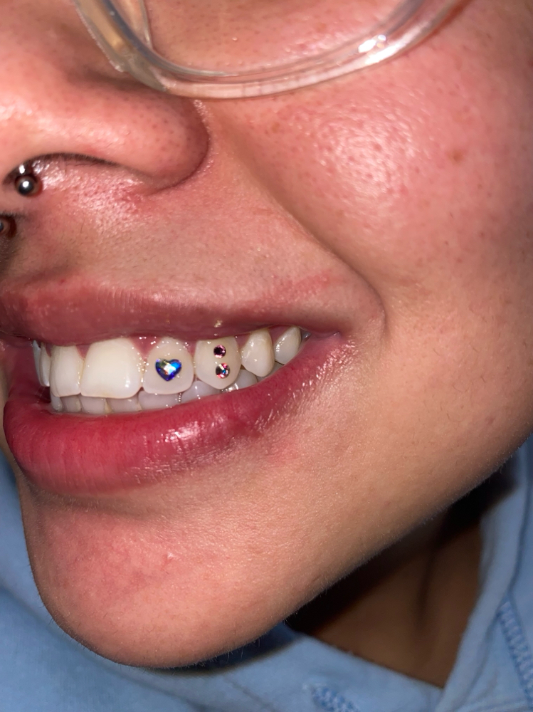 Tooth Gems ✨