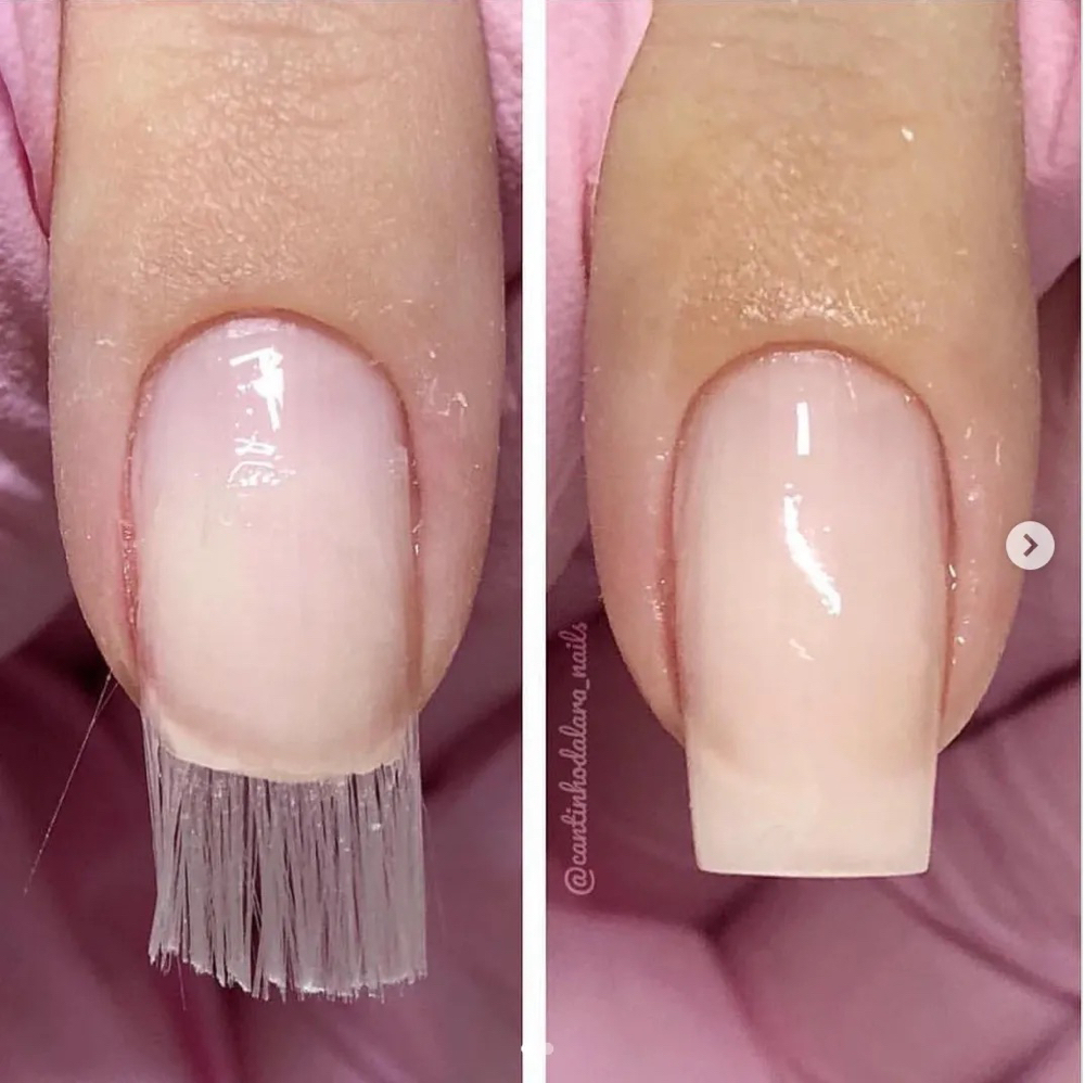 Nail Repair