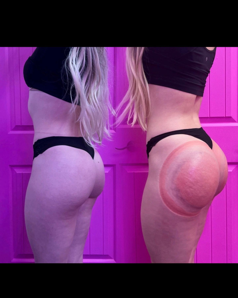 10 Sessions Of Booty Enhancement