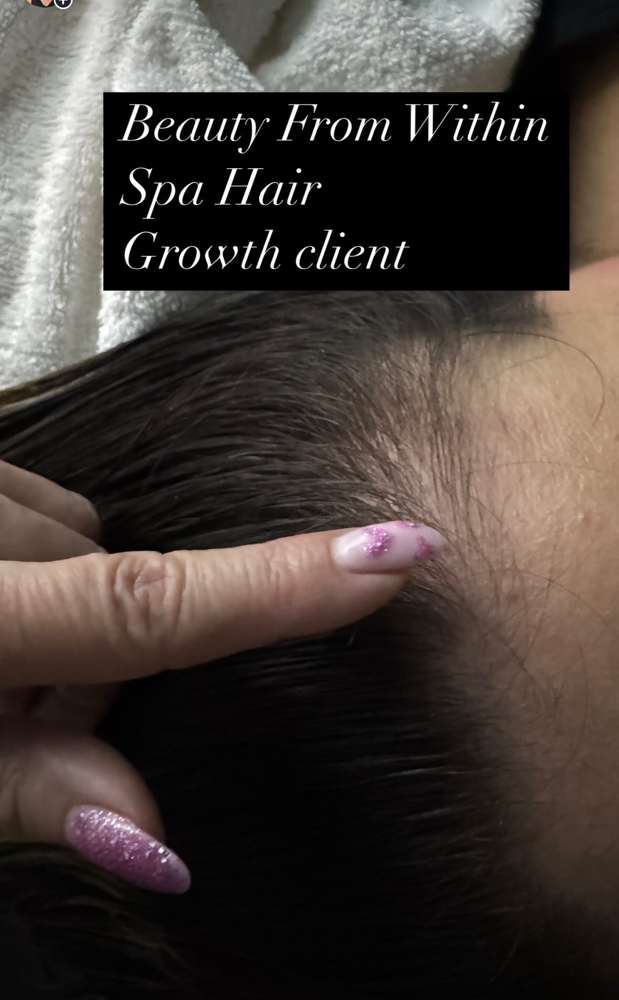 Hairloss Scalp Facial