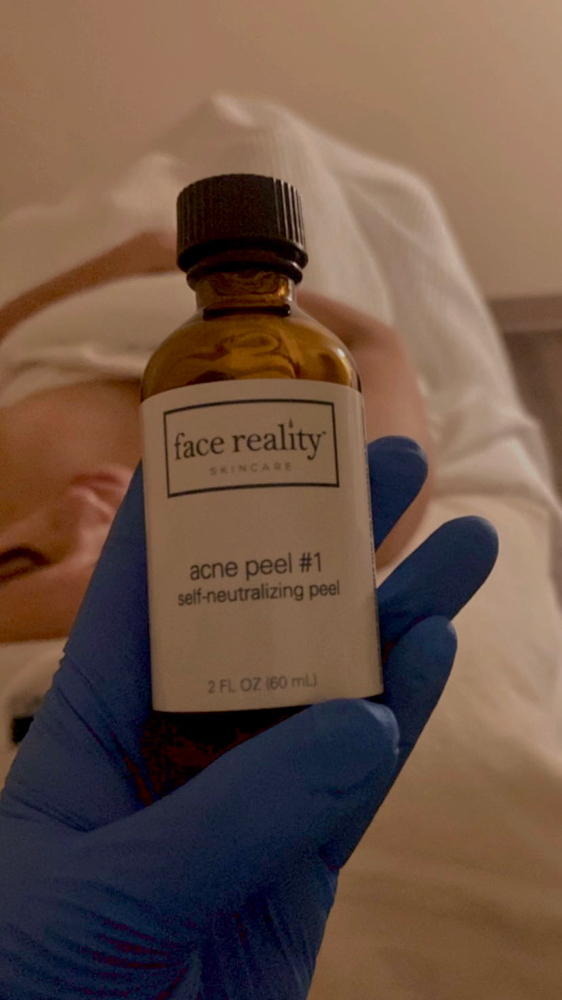 Face Reality Acne Tx 🩵