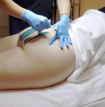 Buttocks Wax