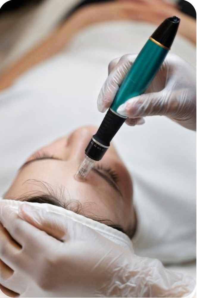 Dermal Needling (micro Needling)