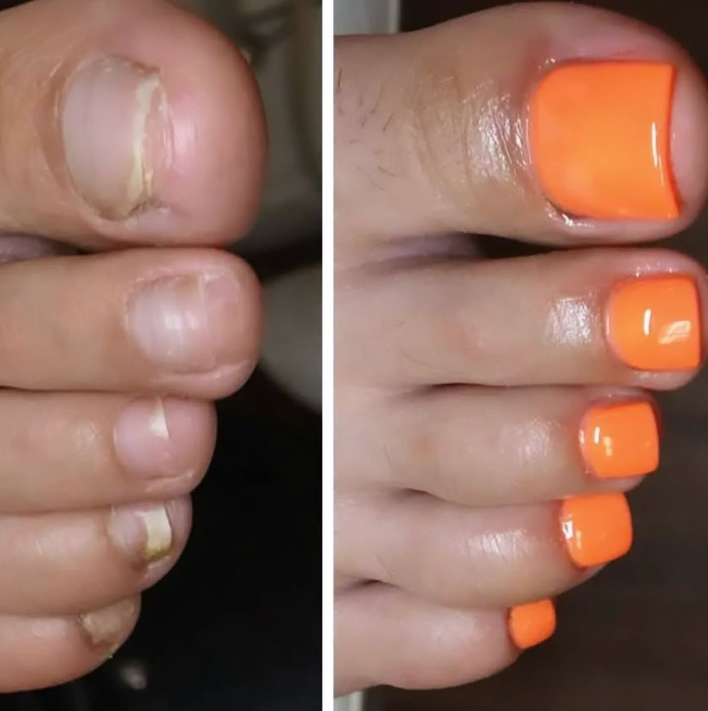 All Toes BBL at Itz_JAMC Nails in Webster, TX