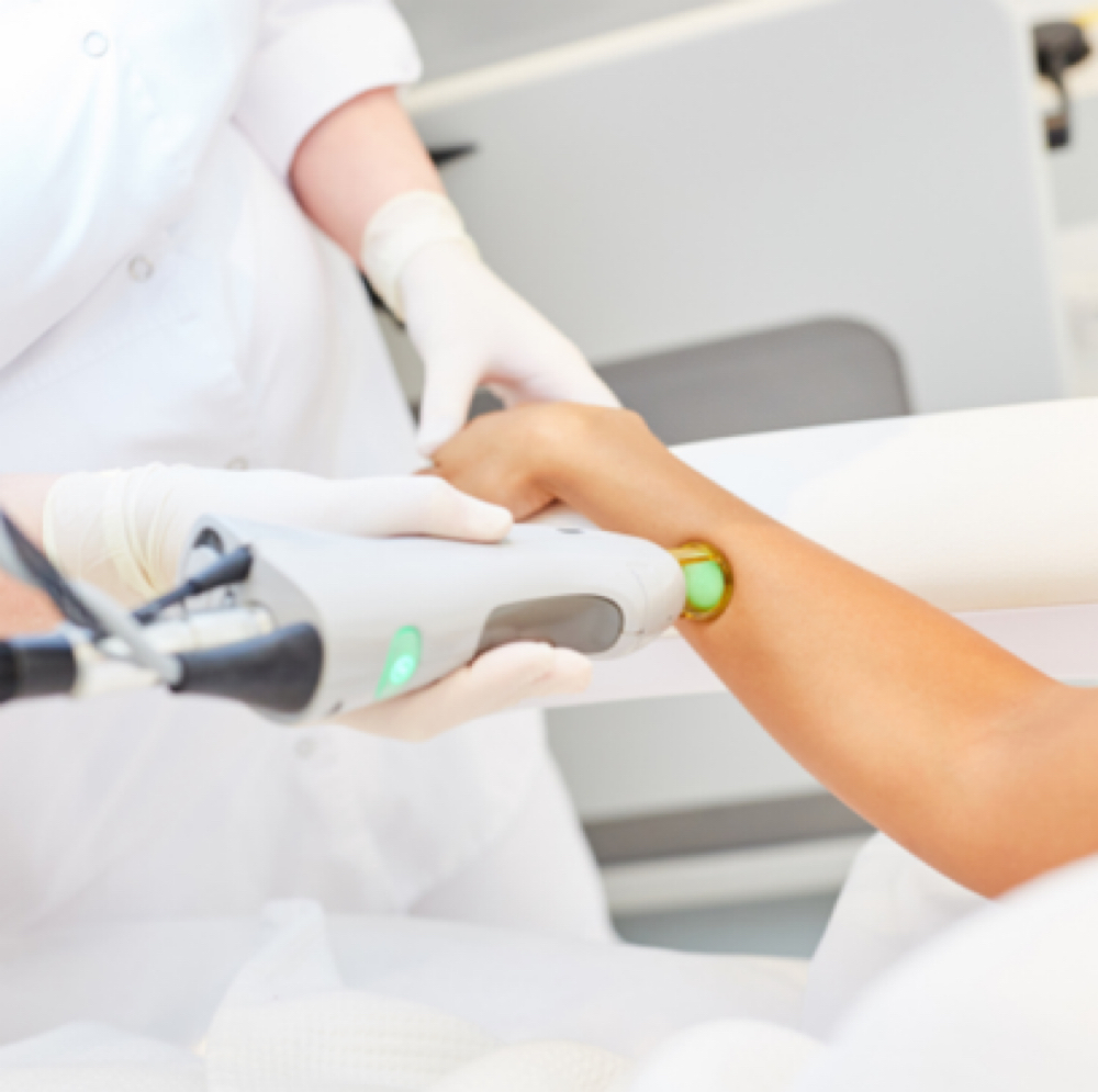 Laser Hair Reduction- Arms at Joy to Beauty in Jupiter, FL