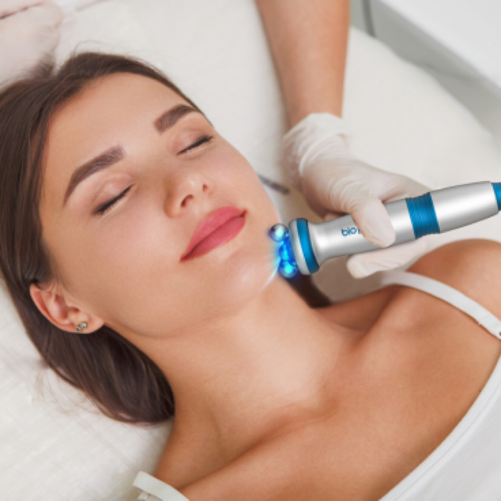 RF Skin Tightening at Estetica in Venice, FL