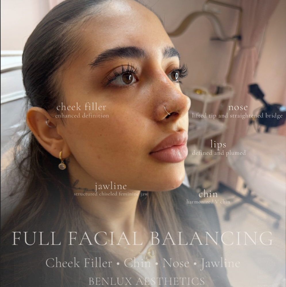 Facial Balancing at Benlux Aesthetics in Alexandria, VA