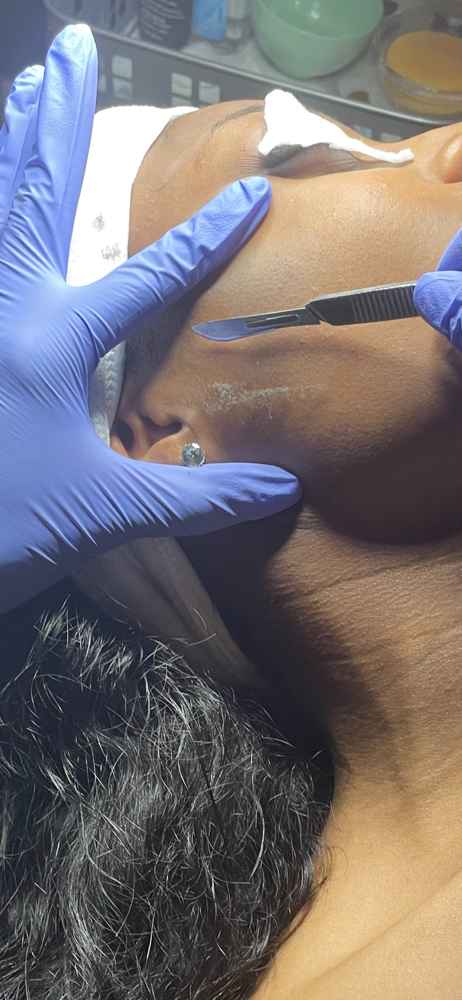 Dermaplaning Facial