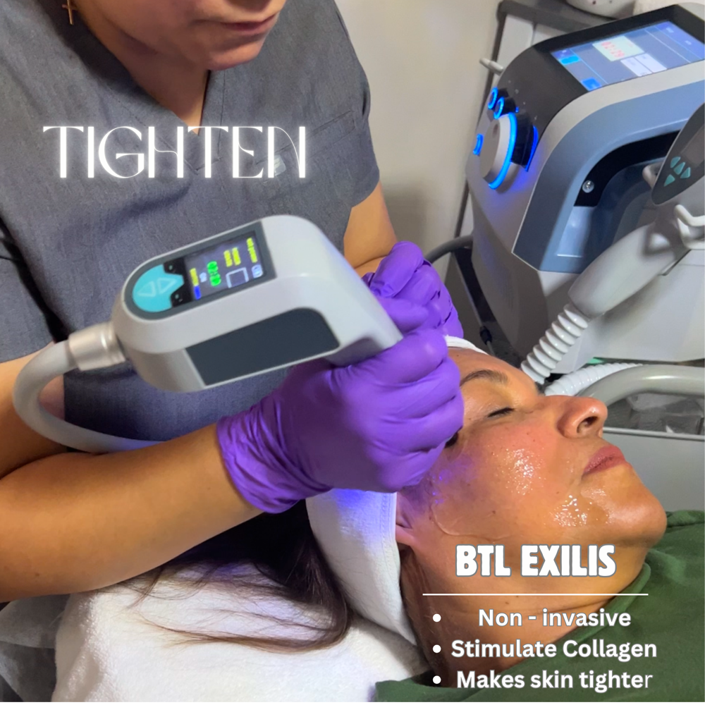Exilis Ultra 360 Skin Tightening