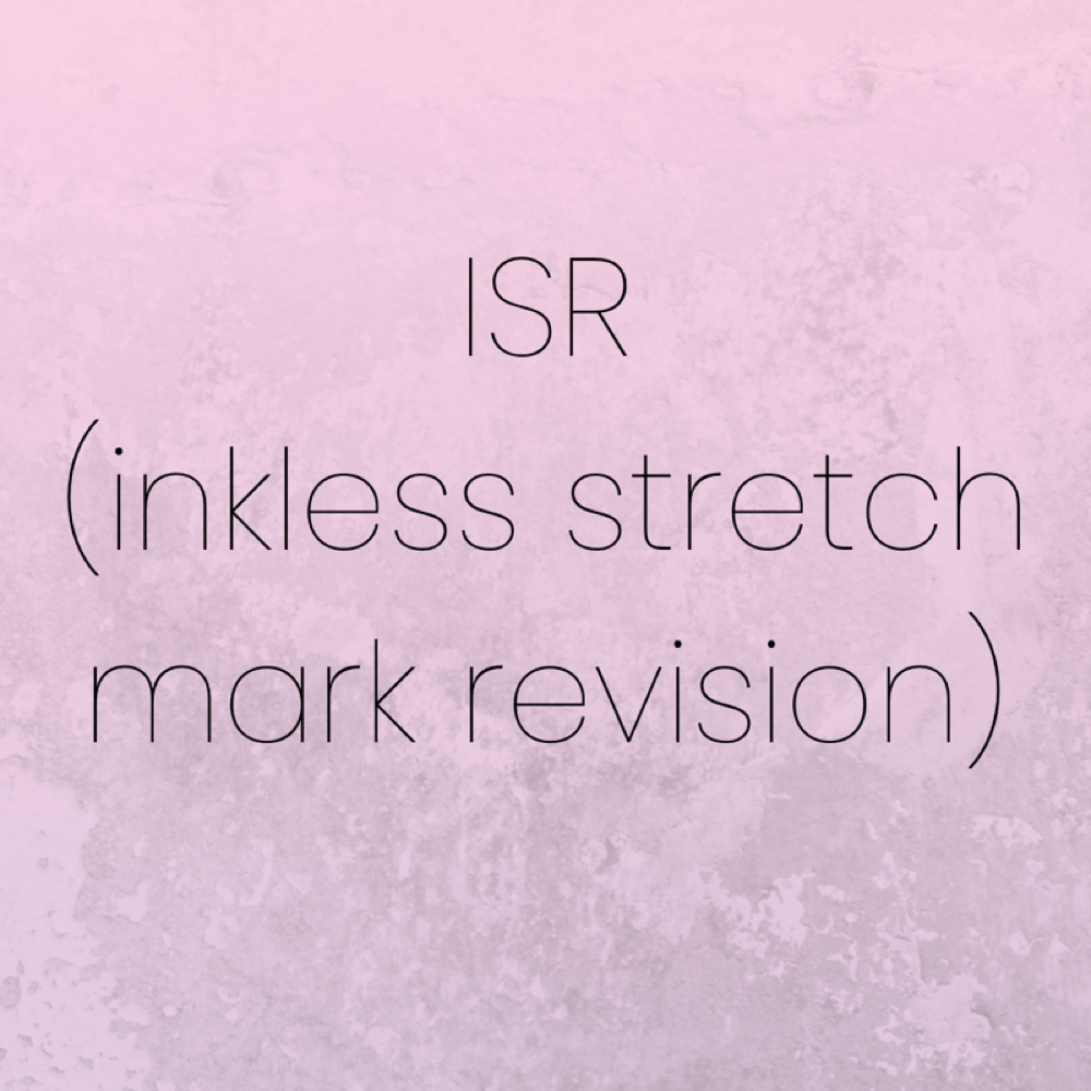 IRS (inkless stretch mark revision) at Pink Ink Vancouver in Vancouver, WA