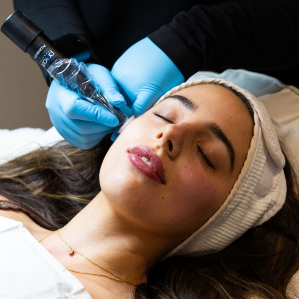 Microchanneling | Face + Body at Triple Moon Aesthetics in Albuquerque, NM