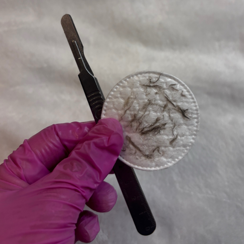 Customized Facial with Dermaplane at Windhorse Esthetics in Loveland, CO