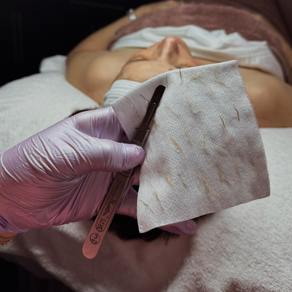 The Refinement (Deluxe Dermaplane F at The Skin Lab in Clinton Twp, MI