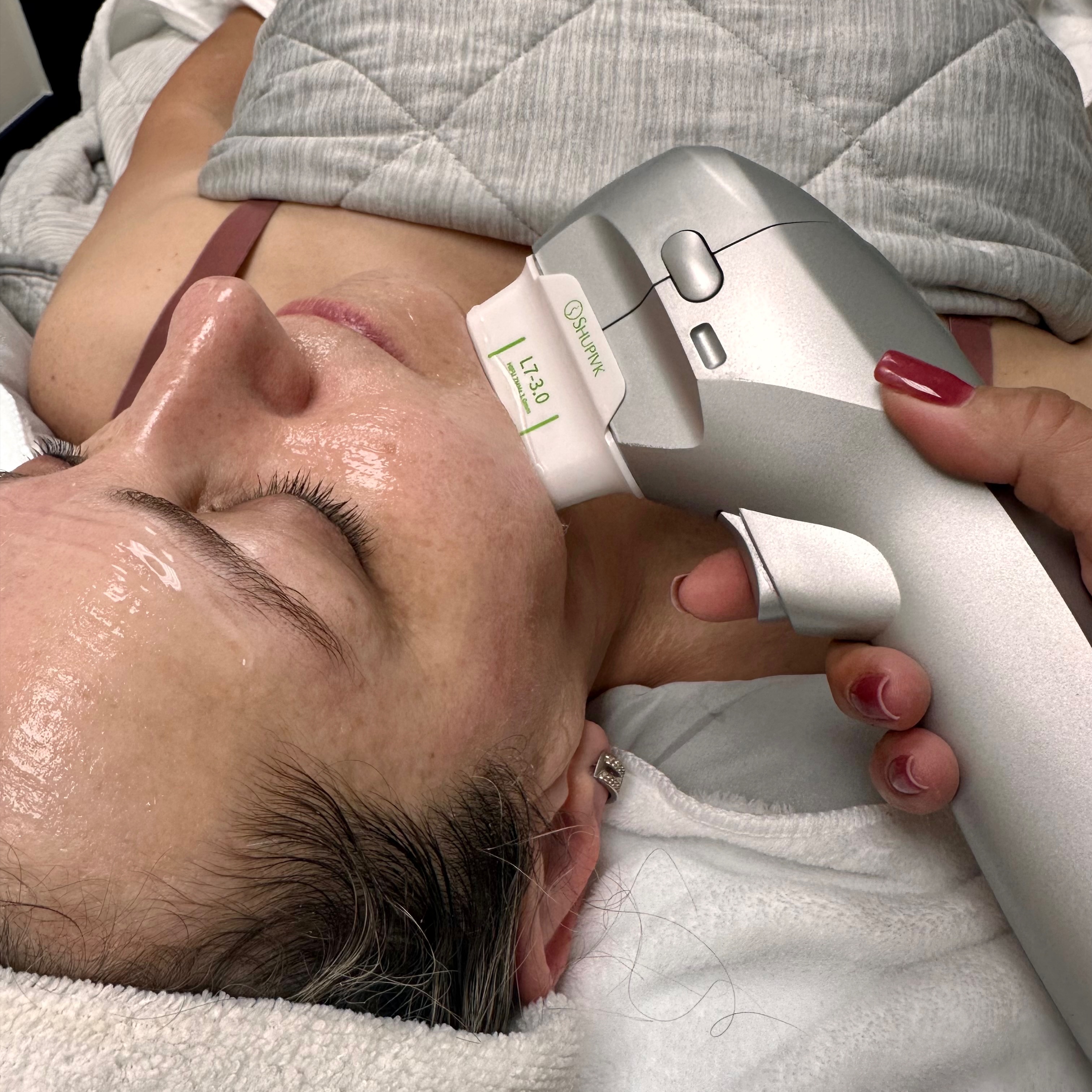HIFU Skin Tightening & Lifting at OpiAva in Austin, TX