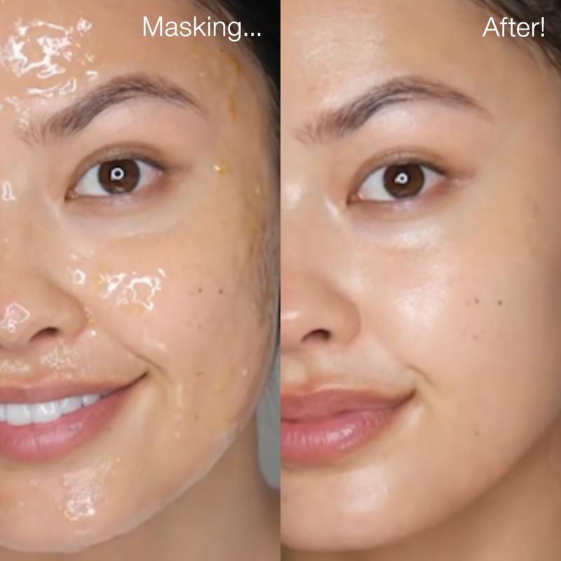 Face Peel