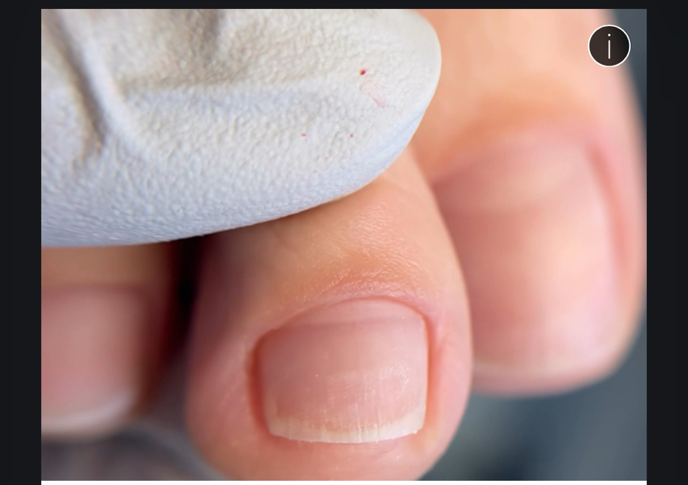 Wellness pedicure using German tech