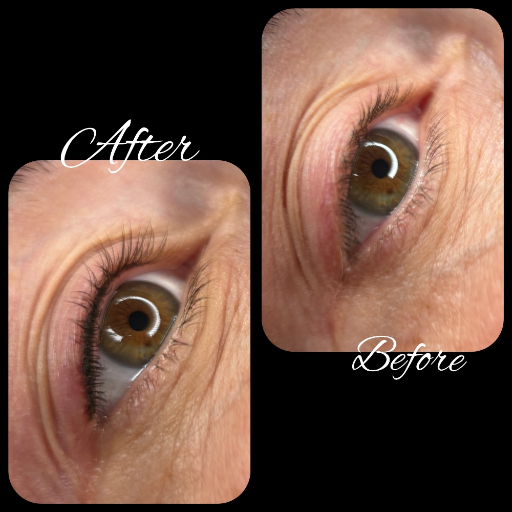 eye line