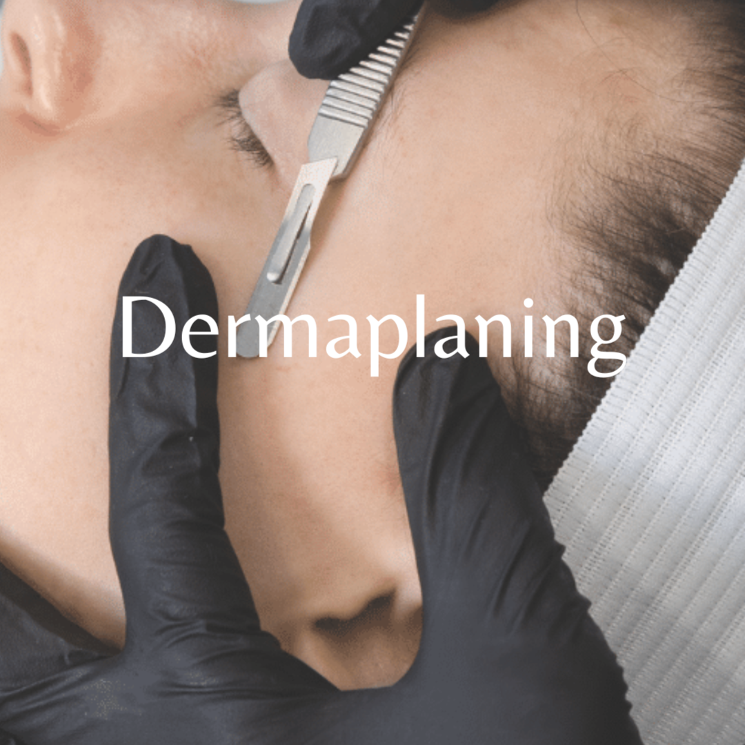Dermaplaning at V Spas in Watertown, MA