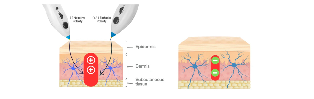 Scar Release Therapy With Microcurrent