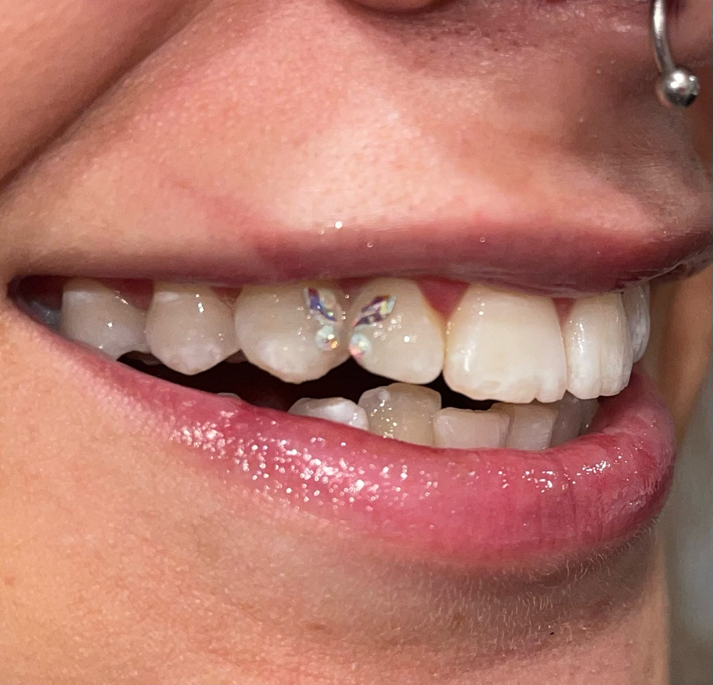 Teeth Gems at The Beauty Lounge in Guthrie, OK